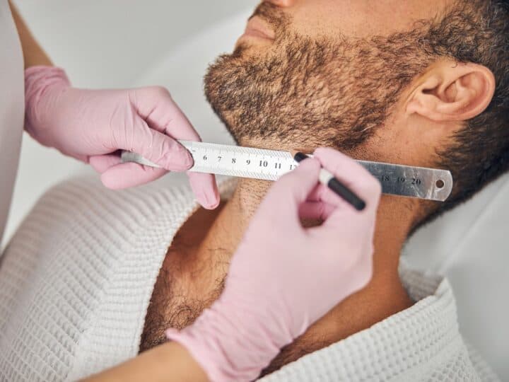 beard transplant cost in thailand what to expect before you go