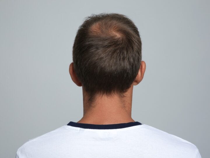 discover hair transplant success rates in thailand vs turkey