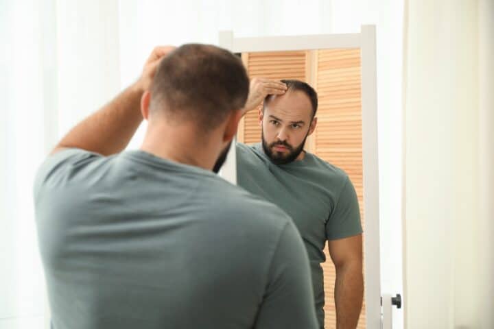 Man looking at his hairline in a mirror