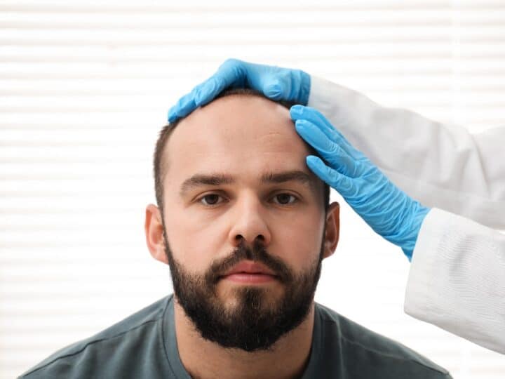 hidden costs of cheap hair transplants