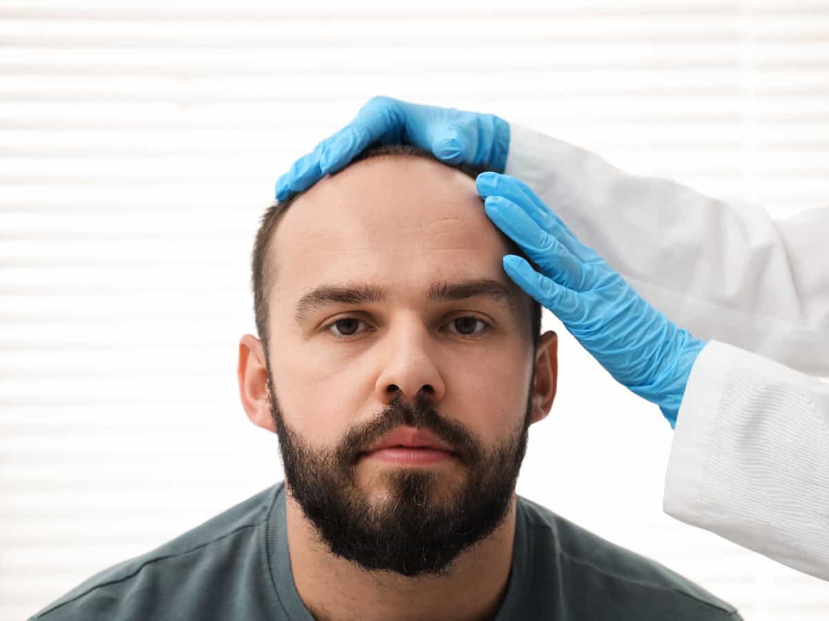 hidden costs of cheap hair transplants