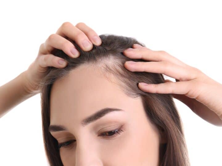 how much does a hair transplant for women cost