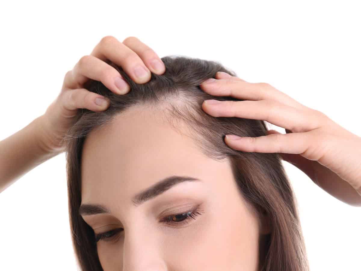how much does a hair transplant for women cost