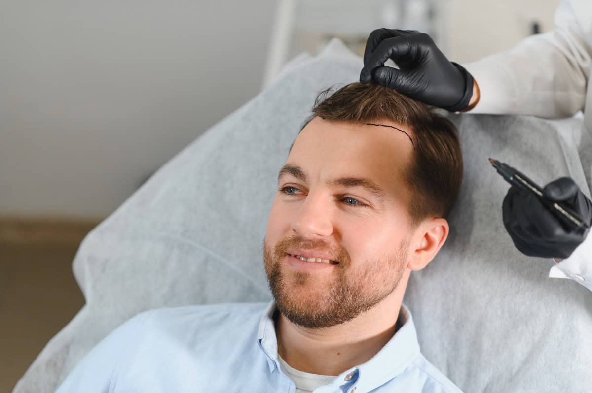 Hairline being marked during a consultation