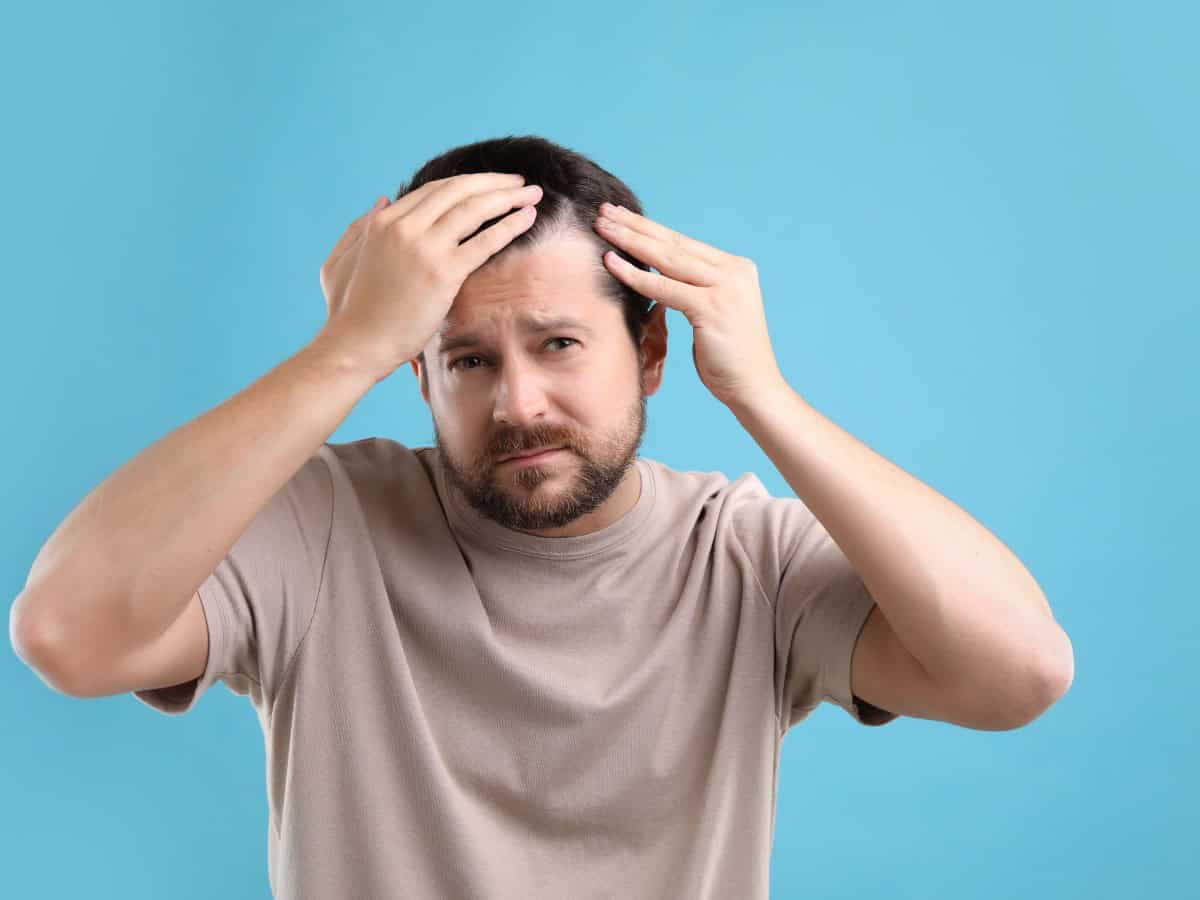 questions to ask before getting a hair transplant abroad