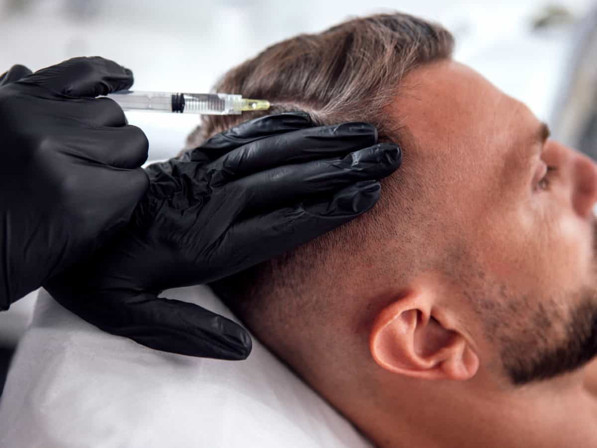 thailand vs turkey hair transplant honest price & quality comparison