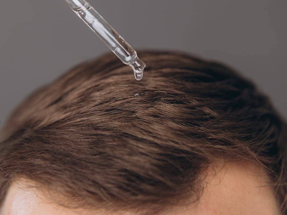 baldness concept man dripping serum onto his hair 2026 03 25 22 39 32 utc (1)