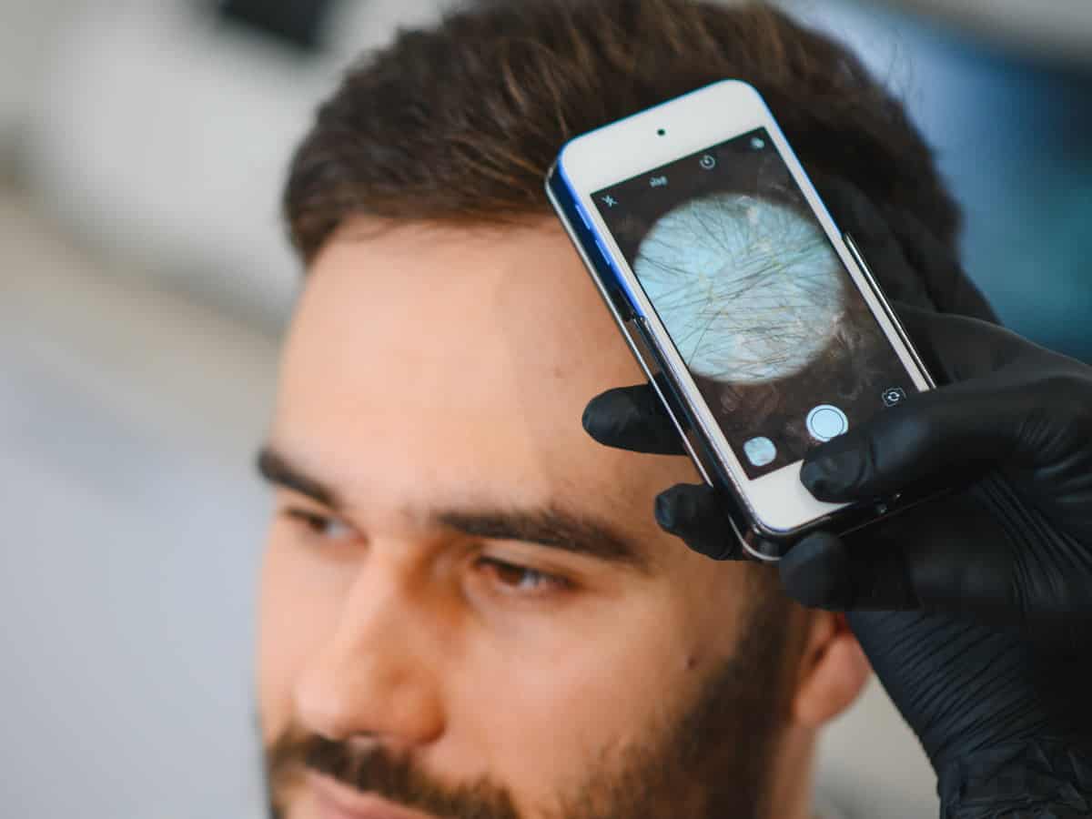 bearded man examines scalp with phone camera 2026 03 31 17 14 30 utc