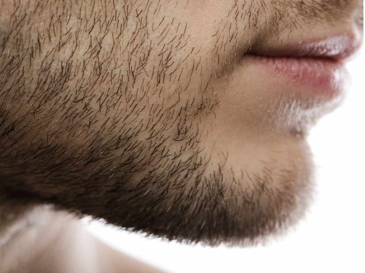 Beard Transplant Cost in Thailand - What to Expect Before You Go close up of male chin and mouth