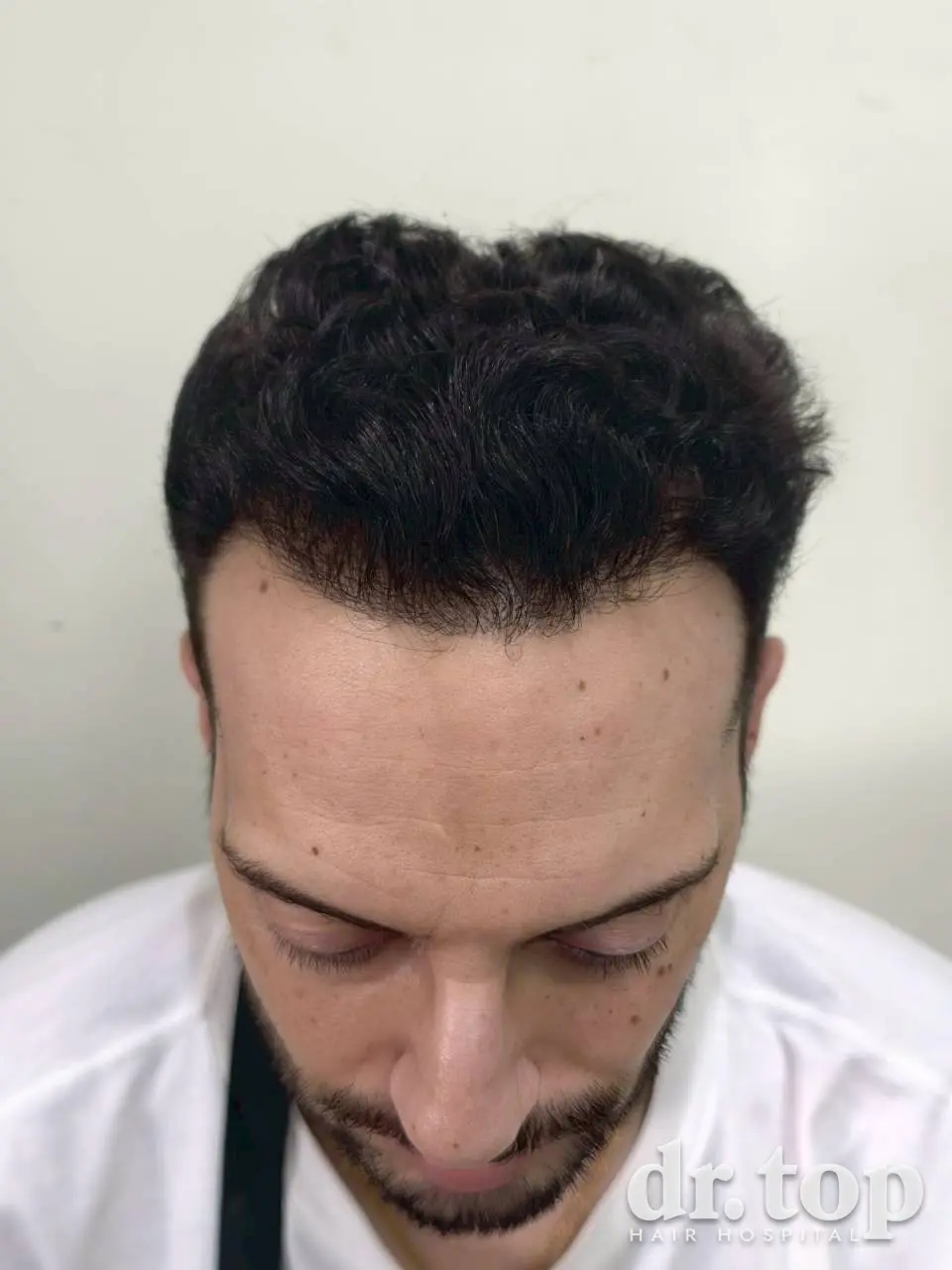 dt 1064 after