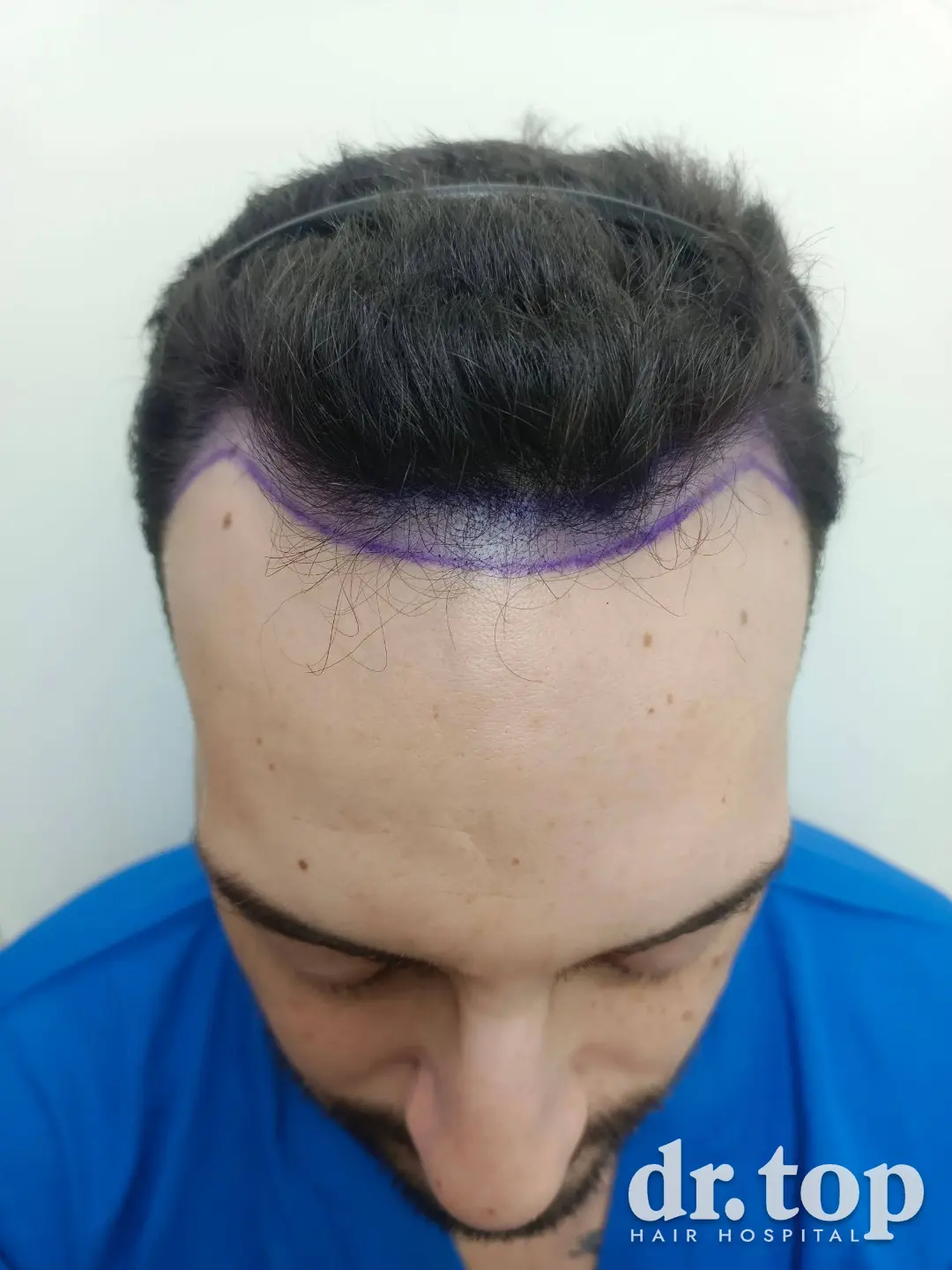 dt 1064 before
