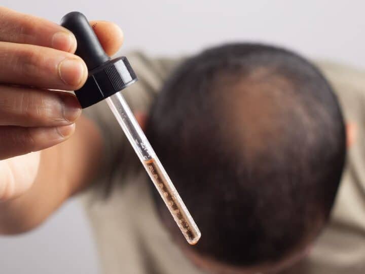 hair loss treatment with serum and dropper 2026 03 18 17 36 41 utc (1)