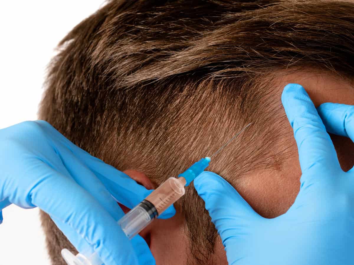 man receiving scalp injection for hair grow