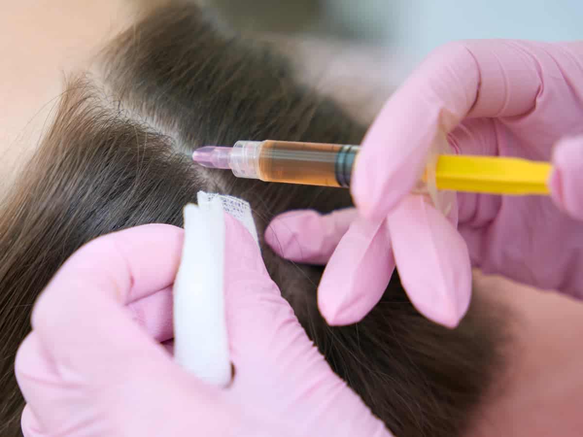 hair treatment procedure close up with syringe 2026 03 20 00 21 09 utc (1)