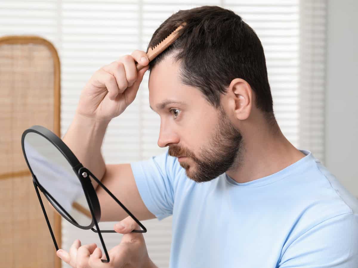 man brushing his hair near mirror indoors. alopecia problem