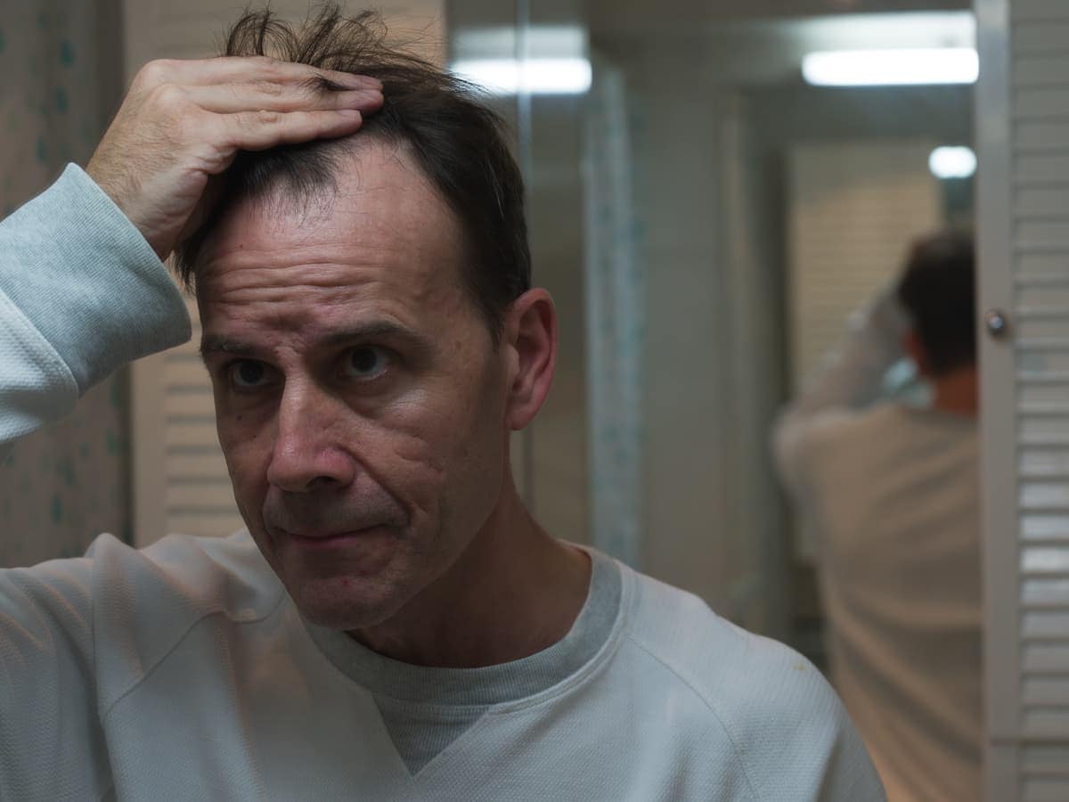 man examines hair loss in a gray bathroom 2026 03 26 22 43 33 utc (1)