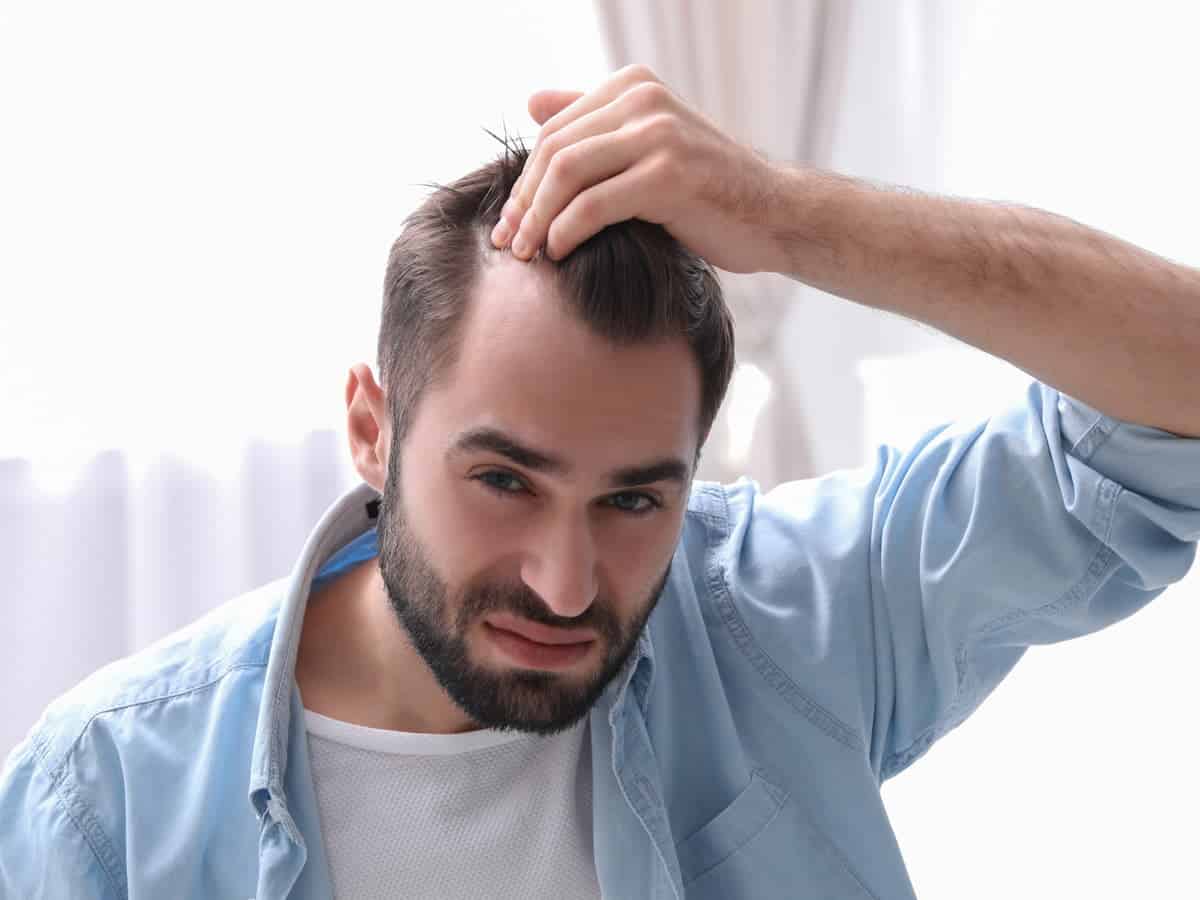 man examines hairline in bright indoor light 2026 03 05 18 33 49 utc