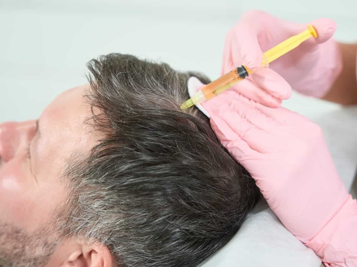man receives hair treatment at medical spa 2026 03 10 02 10 37 utc (1)