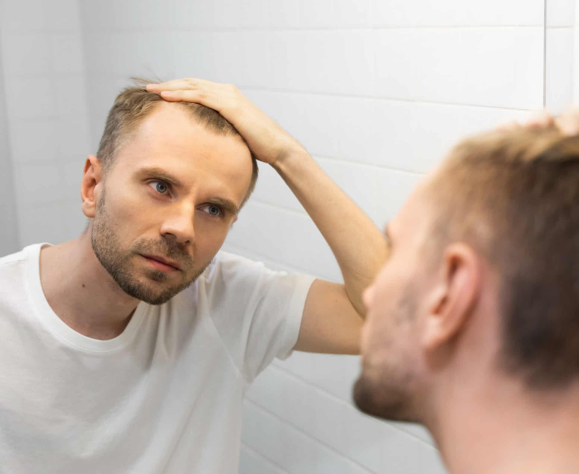middle aged caucasian white man with a short beard looks at his hair in the mirror in the bathroom and worried about balding. the concept of the problem of male hair loss, early baldness and alopecia