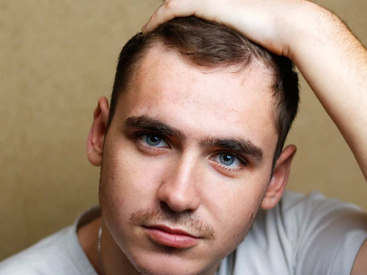 Questions to Ask Before Getting a Hair Transplant Abroad defocus portrait of a young brunette caucasian man on yellow bac