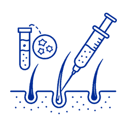 prp hair treatment