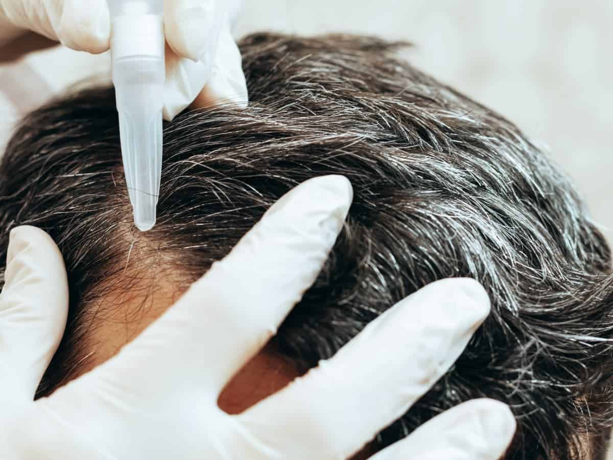 scalp treatment session with professional in glove 2026 03 17 07 23 20 utc (1)